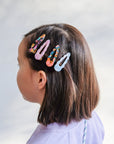 Scalloped Acetate Clips