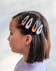 Scalloped Acetate Clips